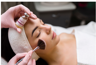 Visualizzazione dei risultati ottenuti tramite combinazione di laser e peeling chimici per l’acne attiva.