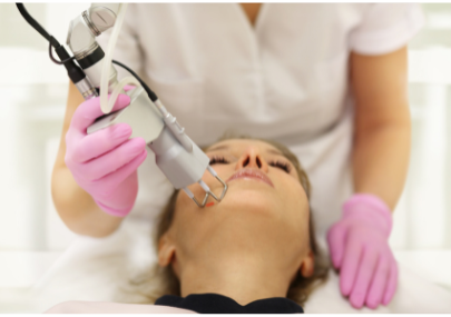 Visualizzazione dei risultati ottenuti tramite combinazione luce pulsata per l’acne attiva.