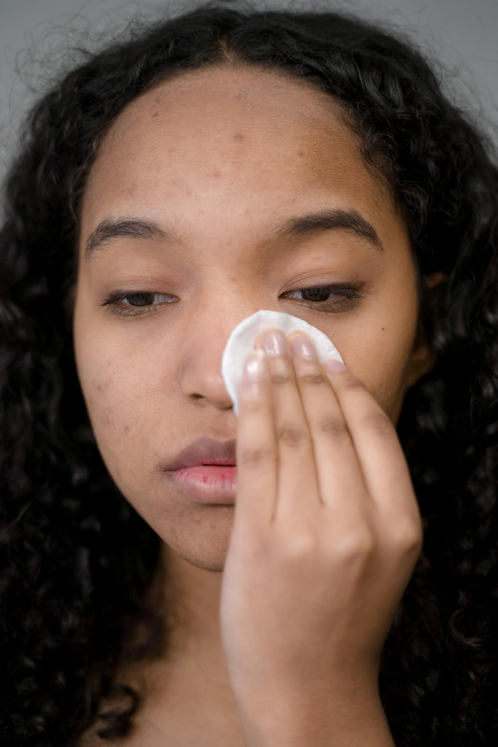 Donna durante la routine di skincare per acne, mentre applica un dischetto detergente sul viso con un gesto delicato e mirato.