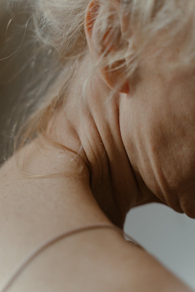 Dettaglio collo matura - ideale per trattamenti di biorivitalizzazione viso e collo a Torino.